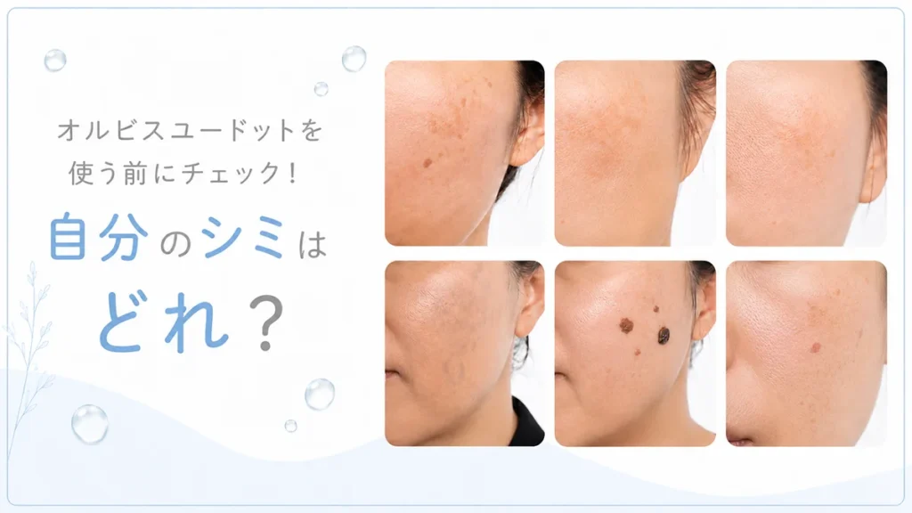 オルビスユードットを使う前にチェック!自分のシミはどれ?